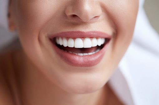 close up of someone's gorgeous smile after treatment for enamel issues