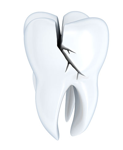 Foods that Can Crack Your Teeth