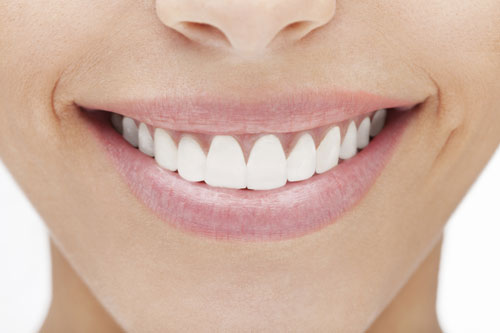 Woman smiling with porcelain veneers